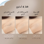 جهاز إزالة الشعر بالليزر IPL من كينسي بيوتي – بعدسات متعددة – 5 مستويات طاقة