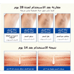 جهاز إزالة الشعر بالليزر المنزلي كينسي بيوتي T16 – لون أزرق – عدسة HR